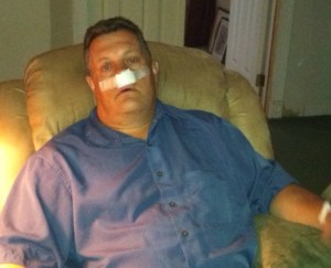 Several hours after outpatient Sinus surgery